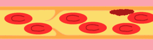 ʲôL(fng)